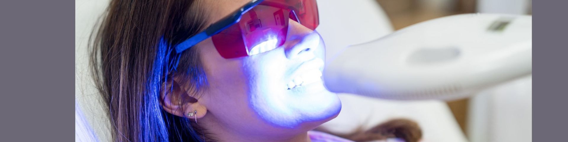 laser teeth whitening laser teeth whitening
