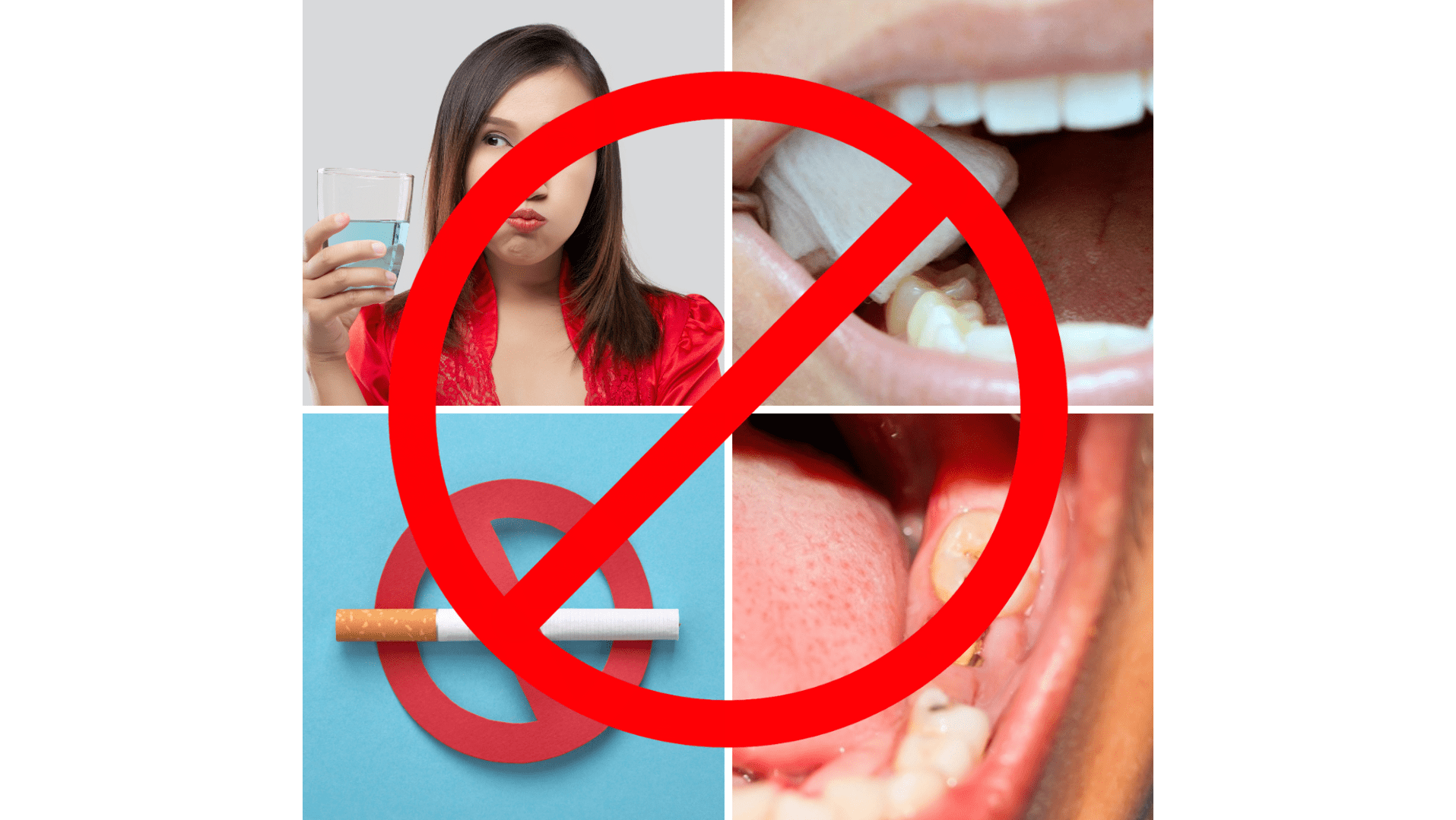 jangan merokok , berkumur , tukar kapas terlalu awal , membiarkan sisa makanan memasuki kawasan cabutan dan makan atau minum makanan atau minuman yang terlalu panas dan sejuk 