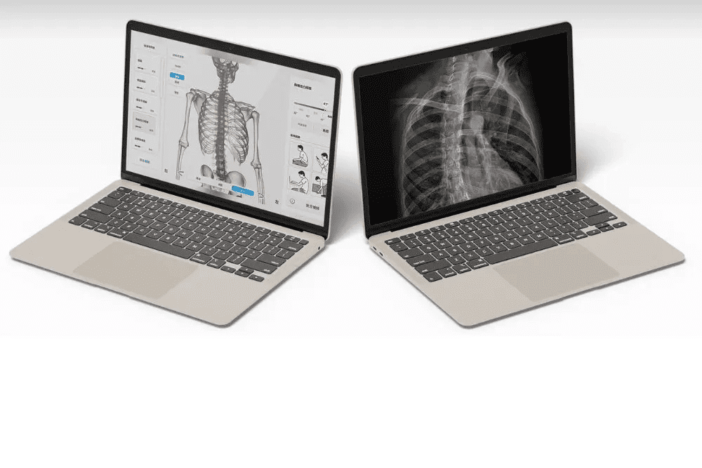 Moti Physio – Postural Analysis