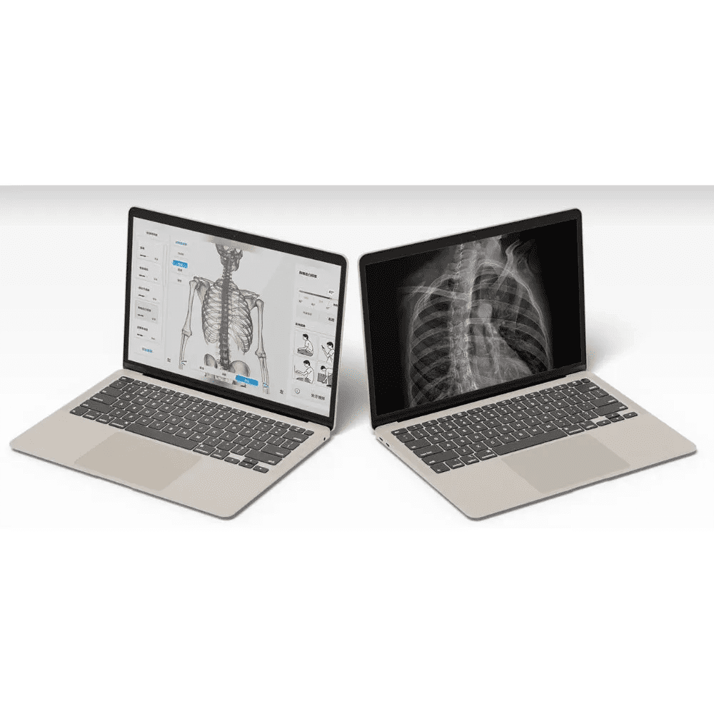 Moti Physio software on a laptop