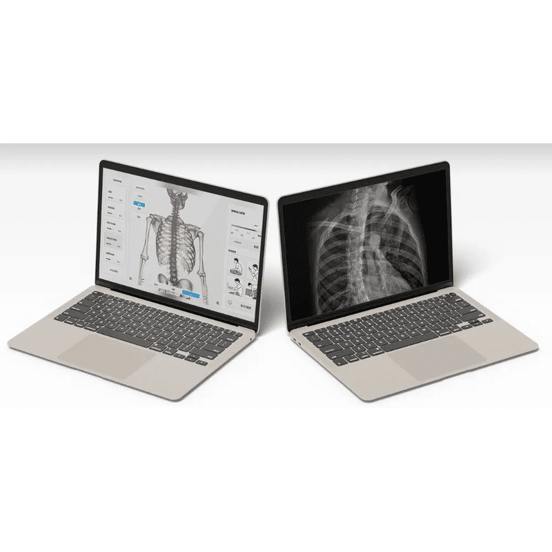 Moti Physio software on a laptop