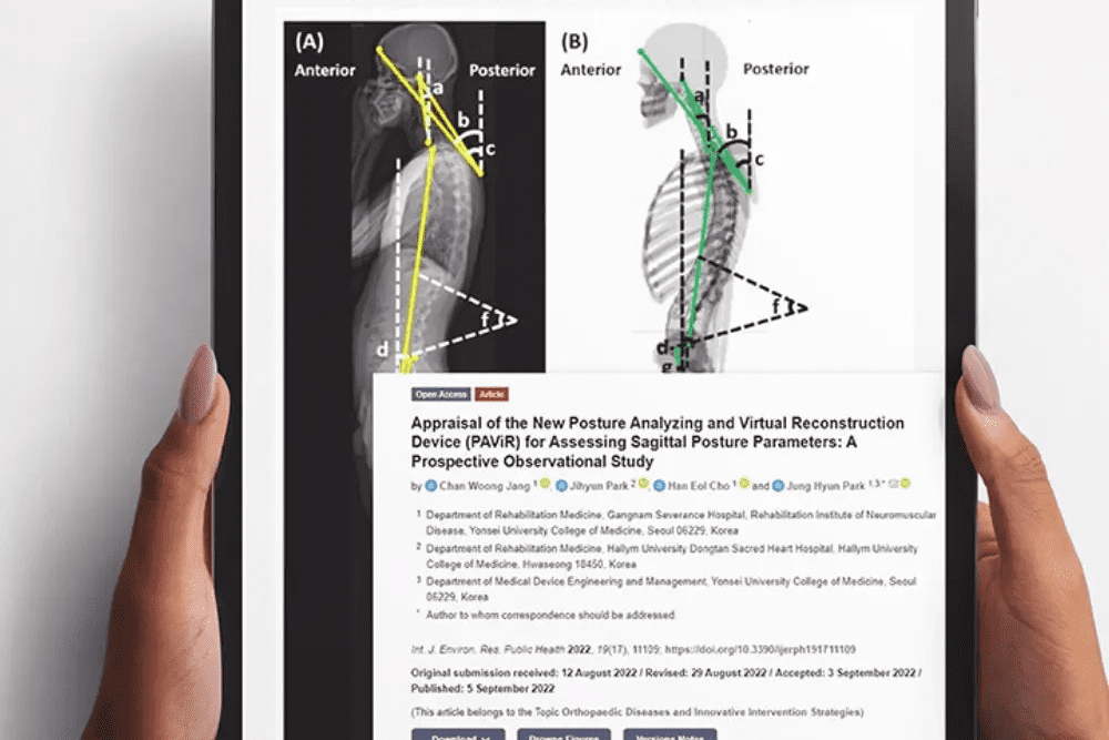 Moti Physio – Postural Analysis