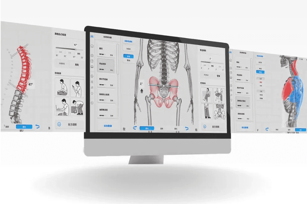 Moti Physio – Postural Analysis