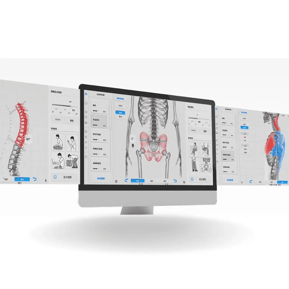 Moti Physio software on a monitor