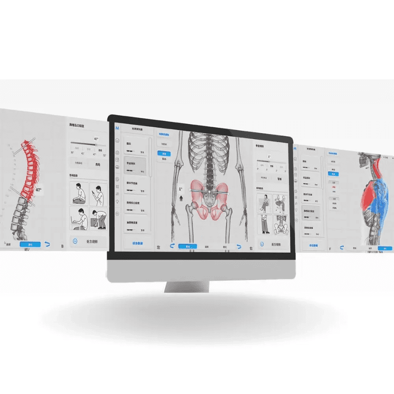 Moti Physio software on a monitor