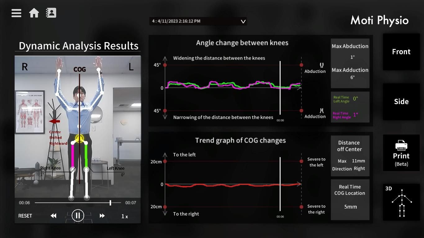 Moti Physio postural analysis