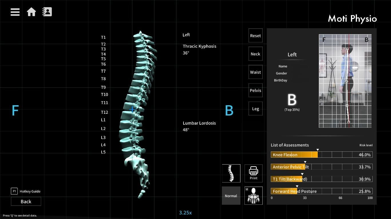 Moti Physio postural analysis