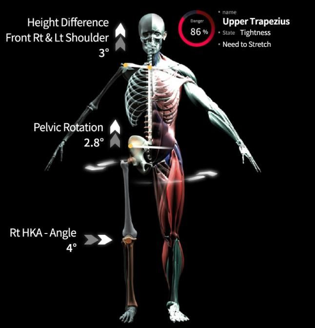 Moti Physio postural analysis