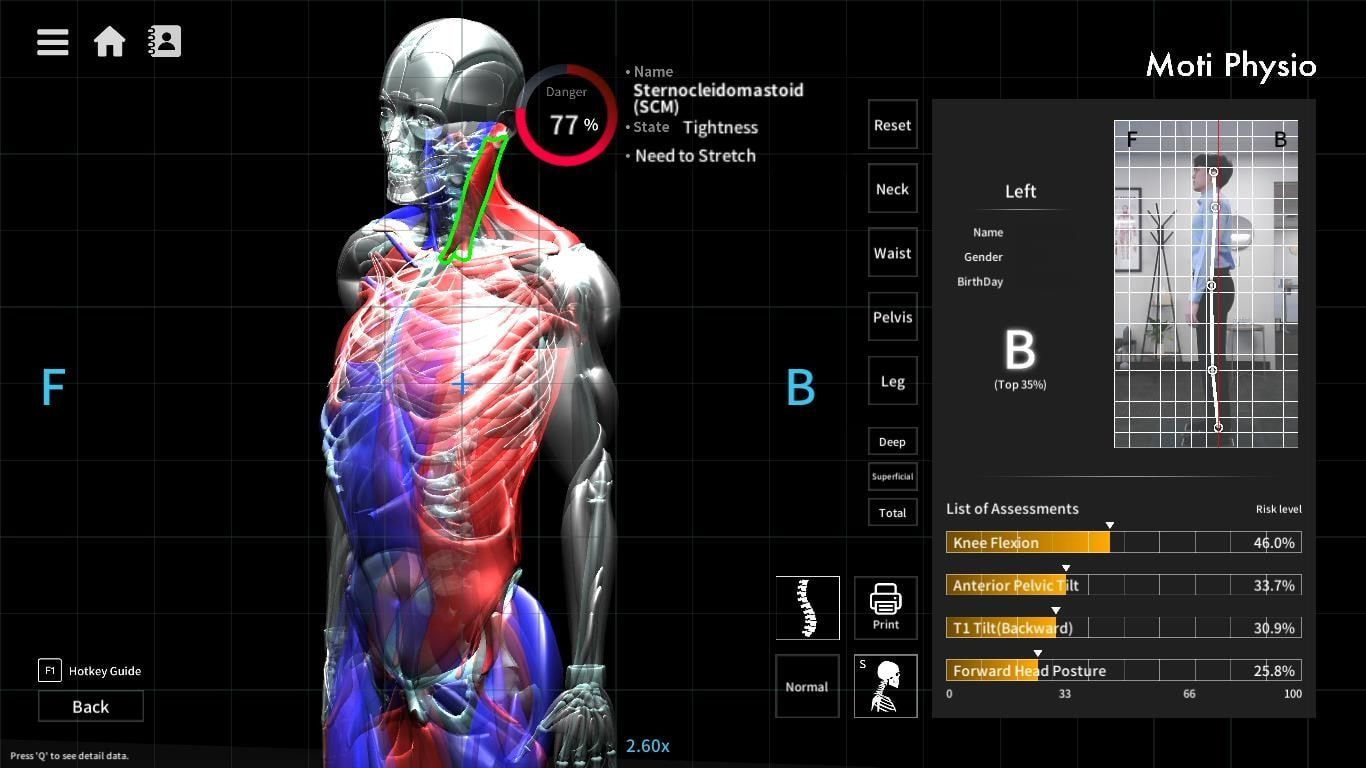 Moti Physio postural analysis