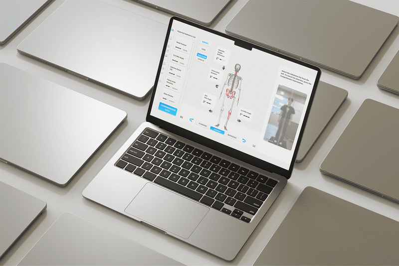 Moti Physio software interface on a laptop