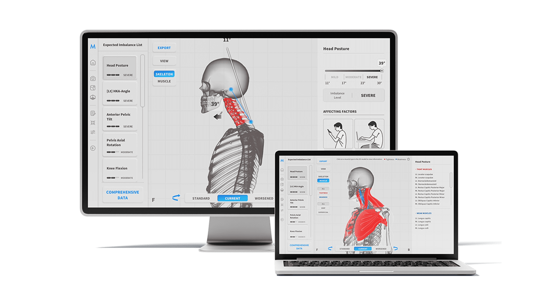Head posture analysis on a monitor and laptop