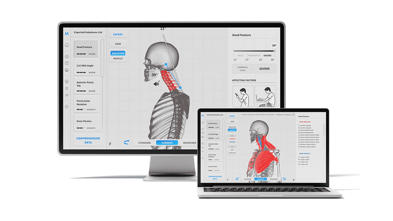 Head posture analysis on a monitor and laptop
