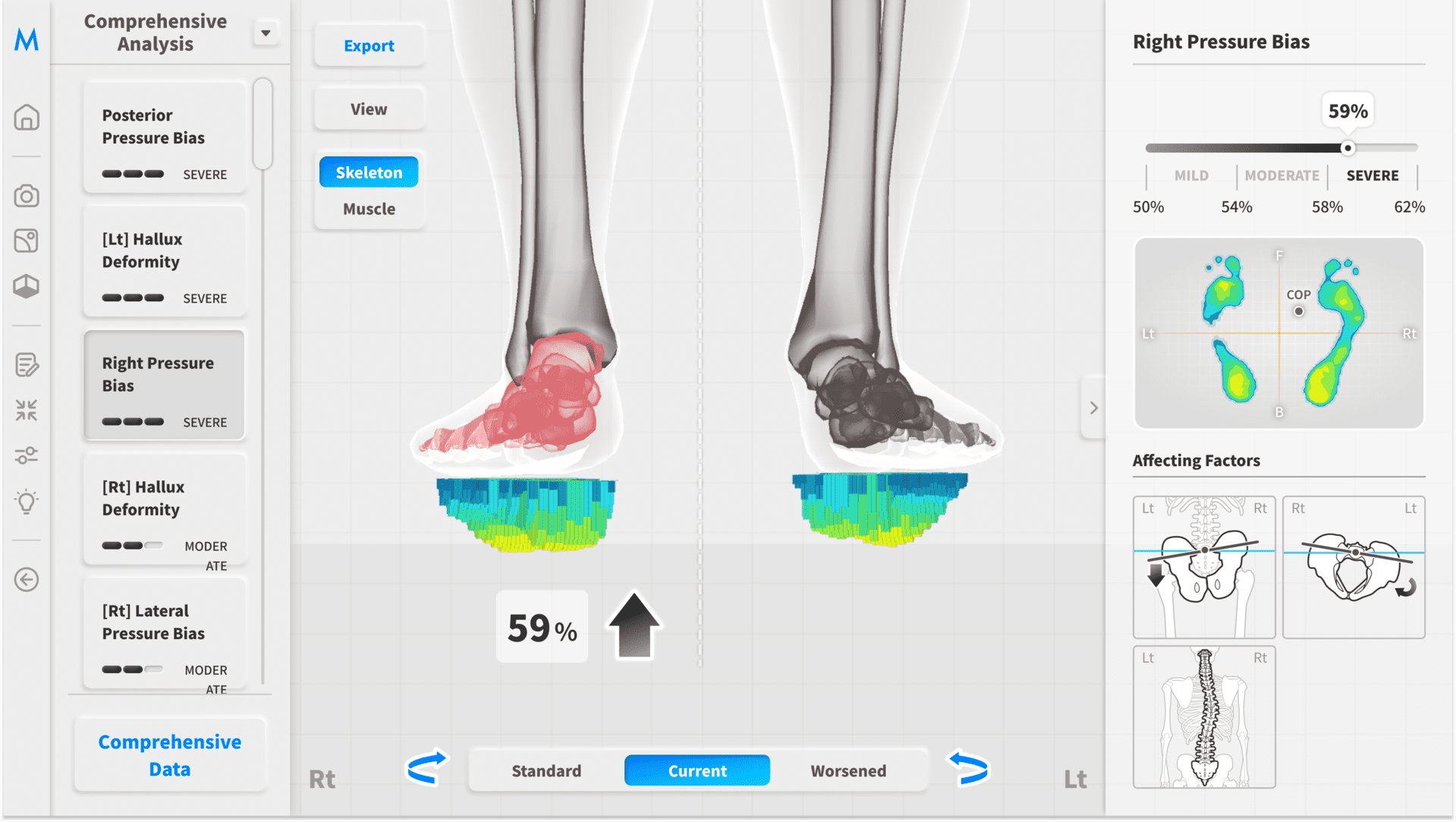 Foot Insight – pressure on the right foot 59%