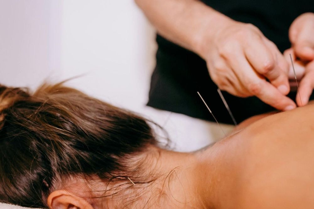 Dry Needling