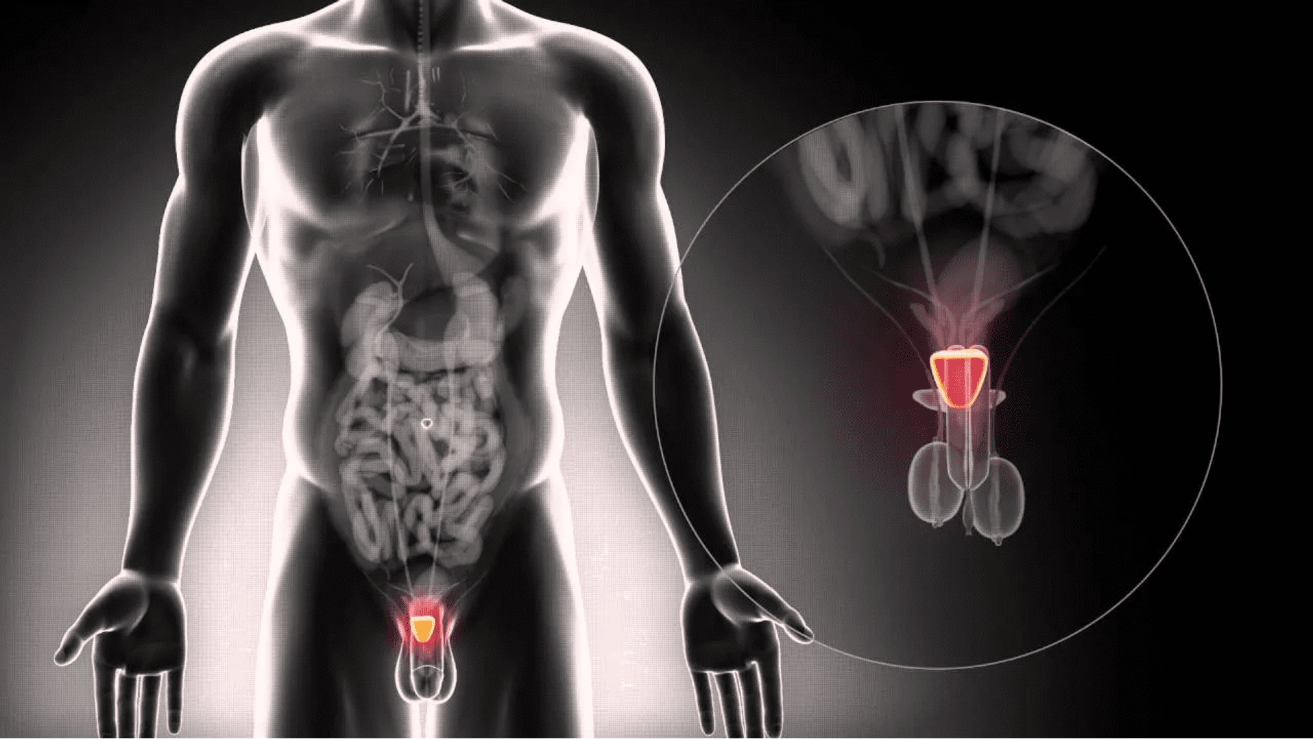 10 Common Causes of Blood in Urine for Men (Hematuria) - Homage